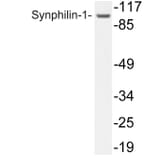 Western Blot - Anti-Synphilin-1 Antibody (R12-2371) - Antibodies.com