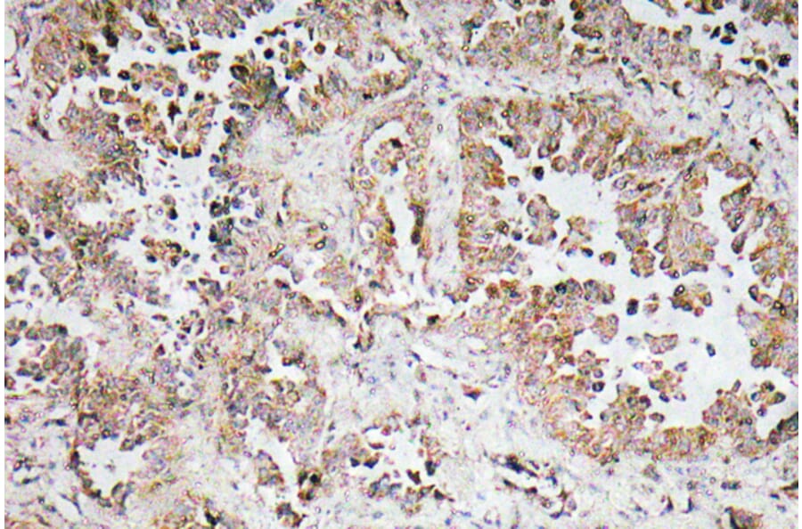 Immunohistochemistry - Anti-Synphilin-1 Antibody (R12-2371) - Antibodies.com