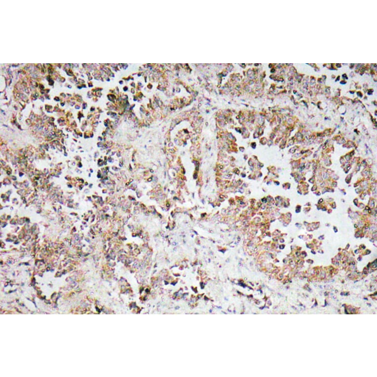 Immunohistochemistry - Anti-Synphilin-1 Antibody (R12-2371) - Antibodies.com