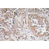 Immunohistochemistry - Anti-Synphilin-1 Antibody (R12-2371) - Antibodies.com