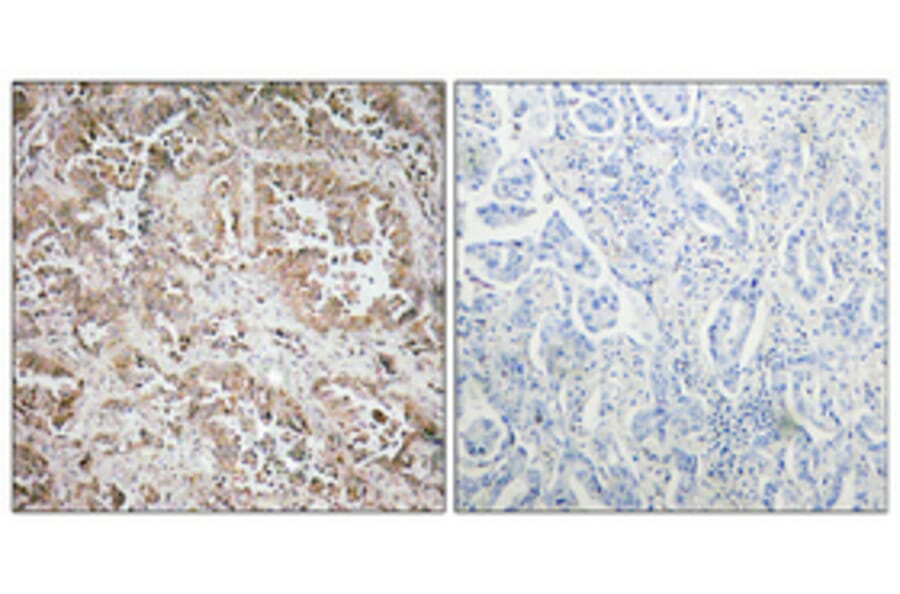 Immunohistochemistry - Anti-Synphilin-1 Antibody (R12-2371) - Antibodies.com