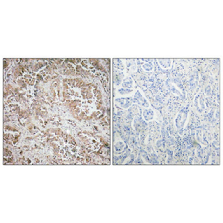 Immunohistochemistry - Anti-Synphilin-1 Antibody (R12-2371) - Antibodies.com