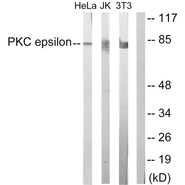 Western Blot - Anti-PKC epsilon Antibody (B0802) - Antibodies.com