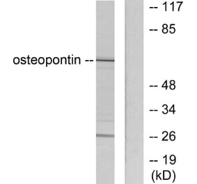 Western Blot - Anti-Osteopontin Antibody (C0284) - Antibodies.com