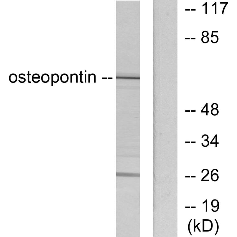 Western Blot - Anti-Osteopontin Antibody (C0284) - Antibodies.com