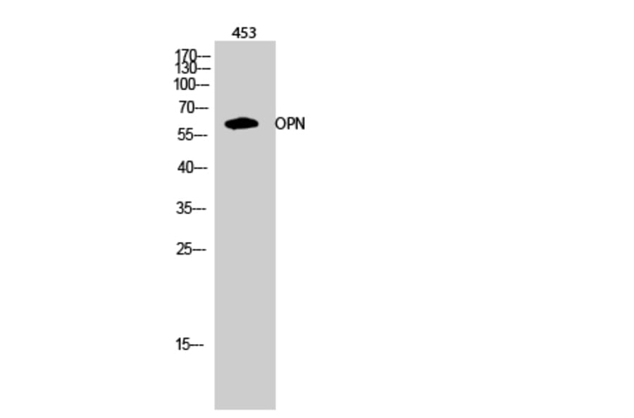 Western Blot - Anti-Osteopontin Antibody (C0284) - Antibodies.com