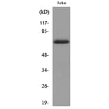 Western Blot - Anti-Keratin-pan Antibody (D12136N) - Antibodies.com