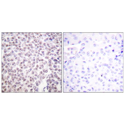 Immunohistochemistry - Anti-Histone H2B Antibody (D0023) - Antibodies.com