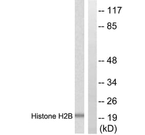 Western Blot - Anti-Histone H2B Antibody (D0025) - Antibodies.com