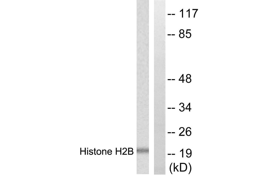 Western Blot - Anti-Histone H2B Antibody (D0025) - Antibodies.com