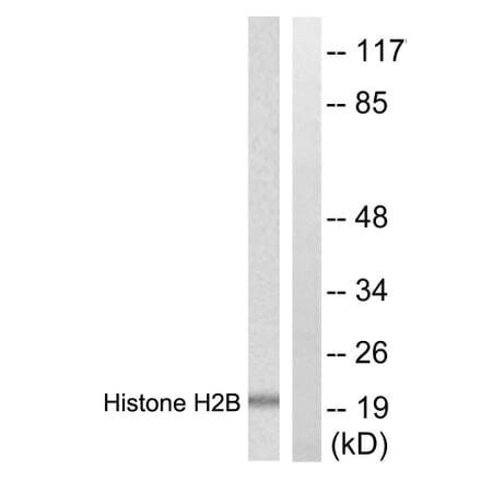 Western Blot - Anti-Histone H2B Antibody (D0025) - Antibodies.com