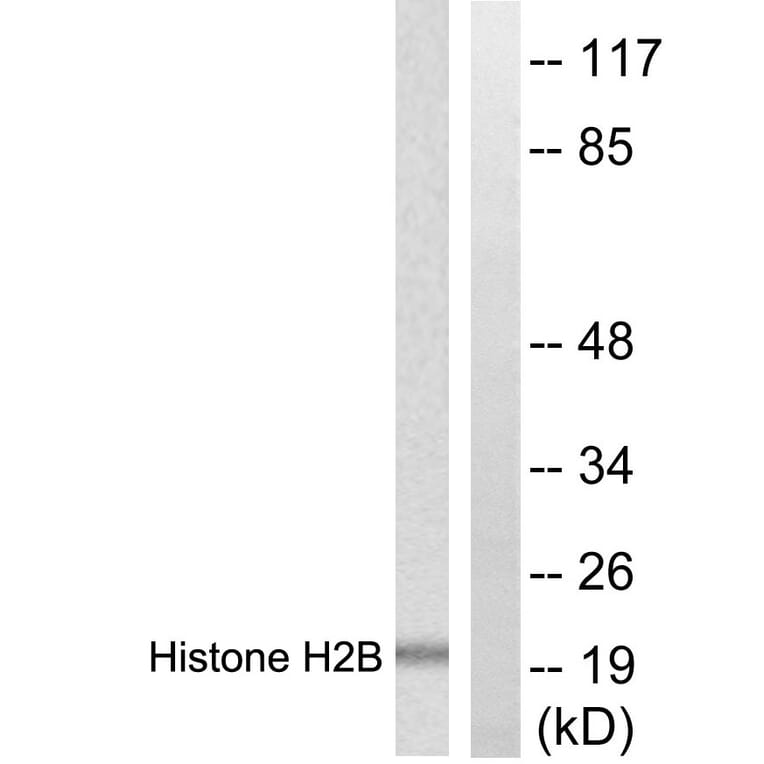 Western Blot - Anti-Histone H2B Antibody (D0025) - Antibodies.com