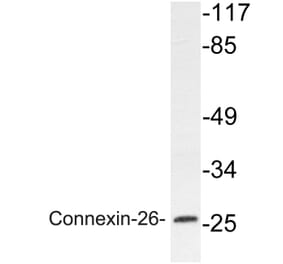 Western Blot - Anti-Connexin-26 Antibody (R12-2098) - Antibodies.com