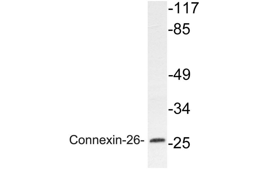 Western Blot - Anti-Connexin-26 Antibody (R12-2098) - Antibodies.com