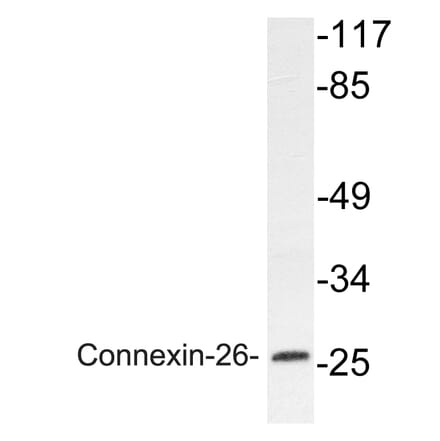 Western Blot - Anti-Connexin-26 Antibody (R12-2098) - Antibodies.com