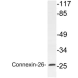 Western Blot - Anti-Connexin-26 Antibody (R12-2098) - Antibodies.com