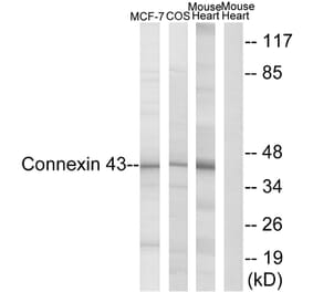 Western Blot - Anti-Connexin 43 Antibody (B7048) - Antibodies.com