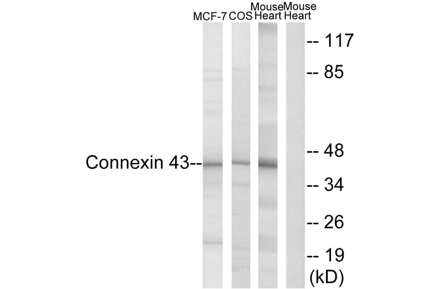 Western Blot - Anti-Connexin 43 Antibody (B7048) - Antibodies.com