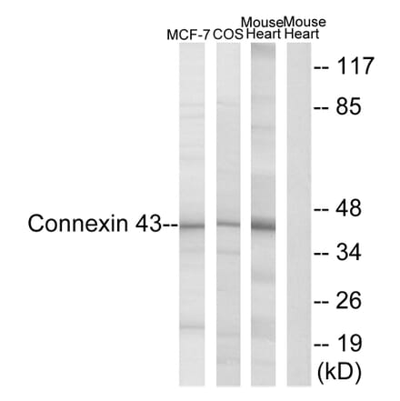 Western Blot - Anti-Connexin 43 Antibody (B7048) - Antibodies.com