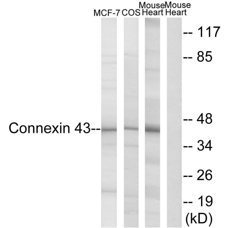 Western Blot - Anti-Connexin 43 Antibody (B7048) - Antibodies.com
