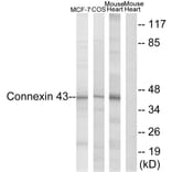 Western Blot - Anti-Connexin 43 Antibody (B7048) - Antibodies.com