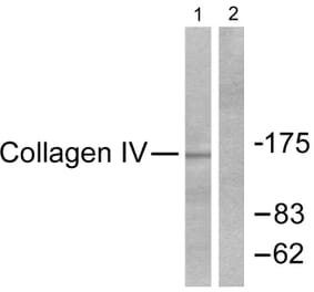 Western Blot - Anti-Collagen IV Antibody (C0157) - Antibodies.com
