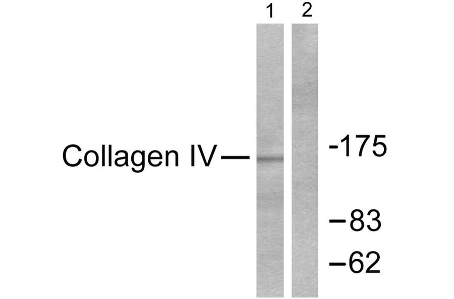 Western Blot - Anti-Collagen IV Antibody (C0157) - Antibodies.com