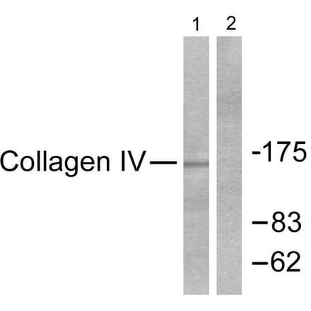 Western Blot - Anti-Collagen IV Antibody (C0157) - Antibodies.com
