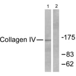 Western Blot - Anti-Collagen IV Antibody (C0157) - Antibodies.com