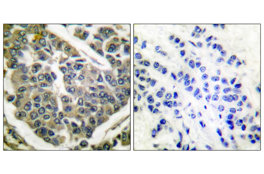 Immunohistochemistry - Anti-Collagen IV Antibody (C0157) - Antibodies.com