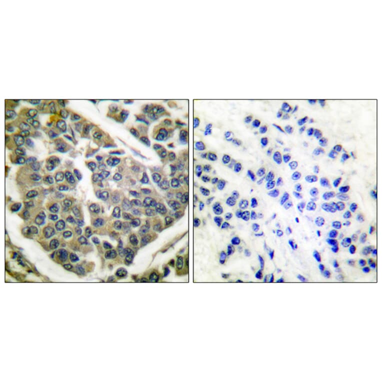Immunohistochemistry - Anti-Collagen IV Antibody (C0157) - Antibodies.com
