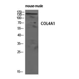 Western Blot - Anti-Collagen IV Antibody (C0157) - Antibodies.com
