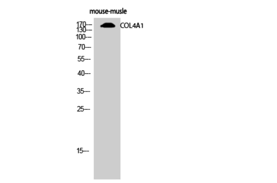 Western Blot - Anti-Collagen IV Antibody (C0157) - Antibodies.com