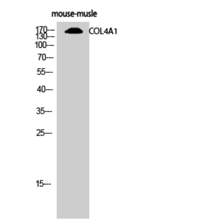 Western Blot - Anti-Collagen IV Antibody (C0157) - Antibodies.com