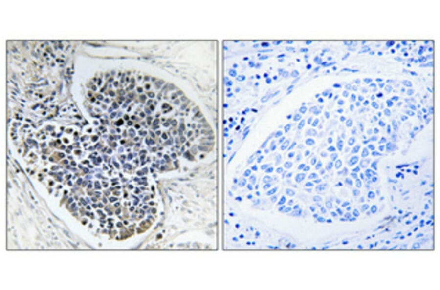 Immunohistochemistry - Anti-Collagen IV Antibody (C0157) - Antibodies.com