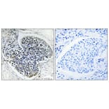 Immunohistochemistry - Anti-Collagen IV Antibody (C0157) - Antibodies.com
