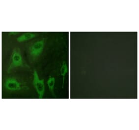 Immunofluorescence - Anti-Aquaporin 2 Antibody (B0768) - Antibodies.com