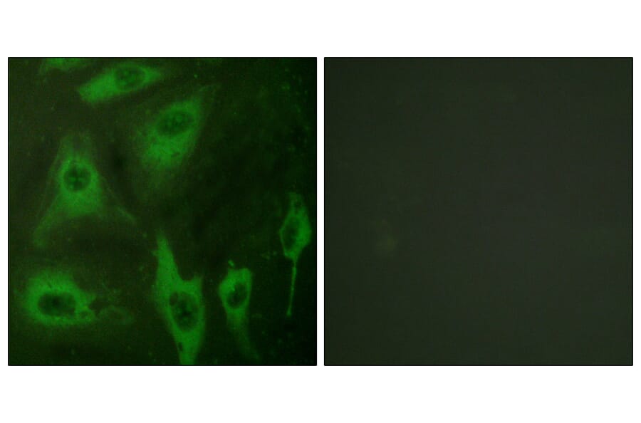 Immunofluorescence - Anti-Aquaporin 2 Antibody (B0768) - Antibodies.com
