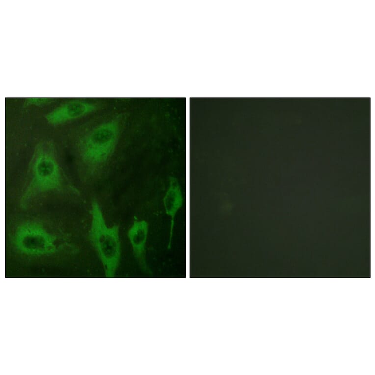 Immunofluorescence - Anti-Aquaporin 2 Antibody (B0768) - Antibodies.com