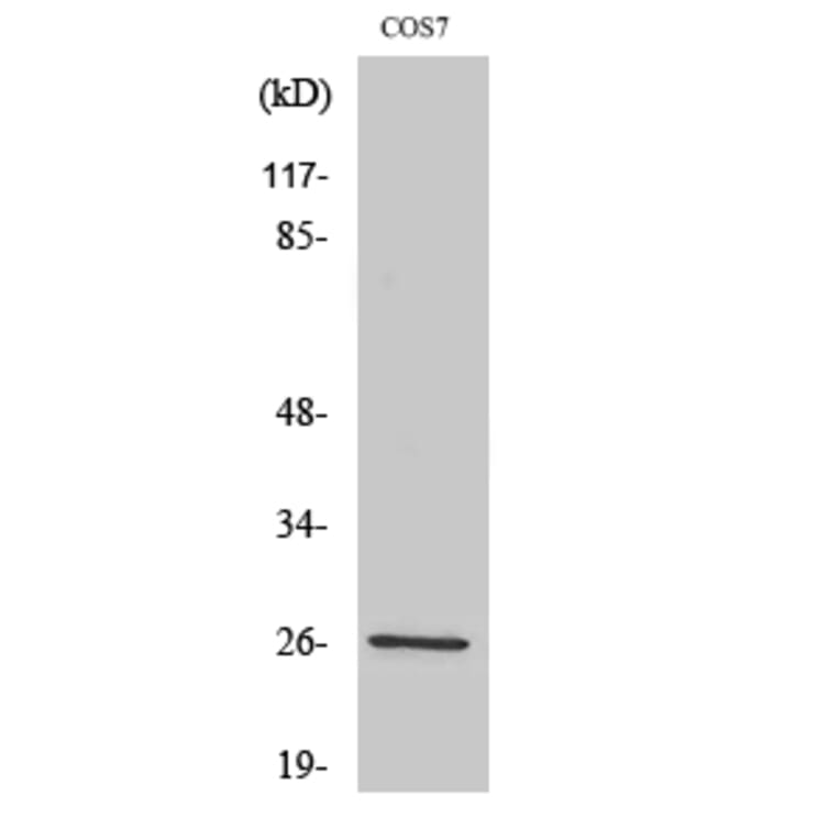Western Blot - Anti-Aquaporin 2 Antibody (B0768) - Antibodies.com