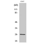Western Blot - Anti-Aquaporin 2 Antibody (B0768) - Antibodies.com