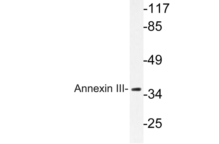 Western Blot - Anti-Annexin III Antibody (R12-2024) - Antibodies.com