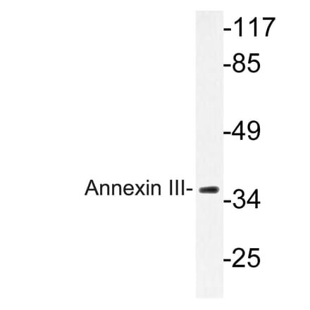 Annexin A3 Antibodies | Antibodies.com