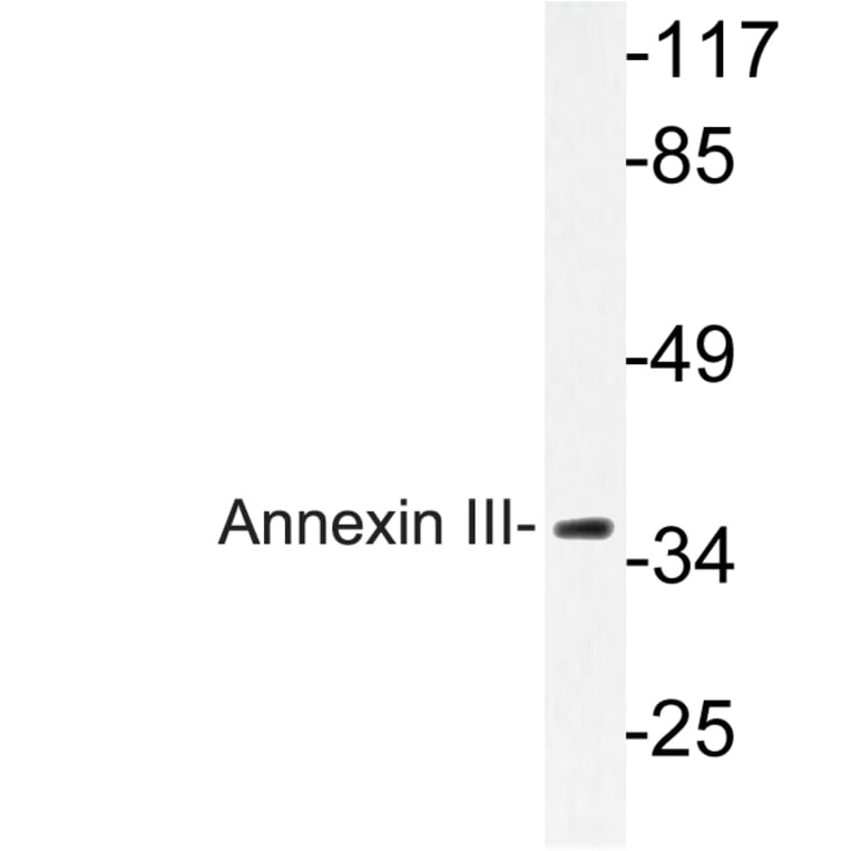 Western Blot - Anti-Annexin III Antibody (R12-2024) - Antibodies.com