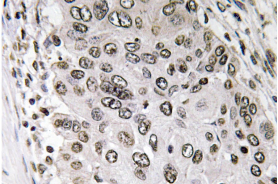 Immunohistochemistry - Anti-Annexin III Antibody (R12-2024) - Antibodies.com