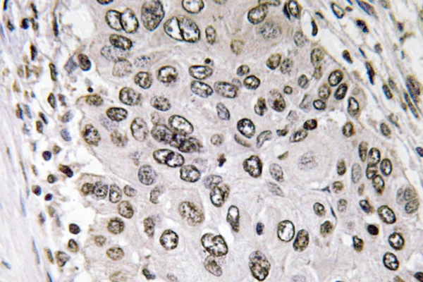 Immunohistochemistry - Anti-Annexin III Antibody (R12-2024) - Antibodies.com