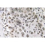 Immunohistochemistry - Anti-Annexin III Antibody (R12-2024) - Antibodies.com