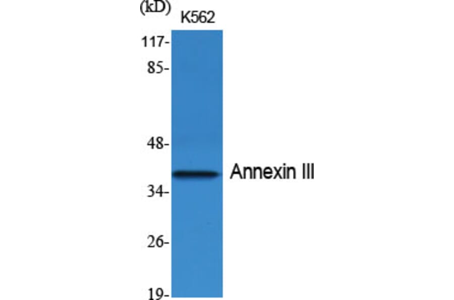 Western Blot - Anti-Annexin III Antibody (R12-2024) - Antibodies.com