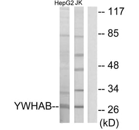 Western Blot - Anti-14-3-3 beta Antibody (C12001) - Antibodies.com