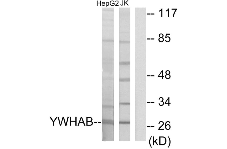 Western Blot - Anti-14-3-3 beta Antibody (C12001) - Antibodies.com
